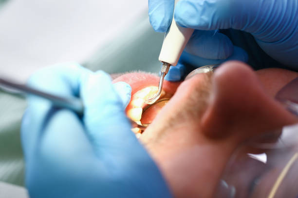 Best Emergency Treatment for Oral Infections in Brookville, NY
