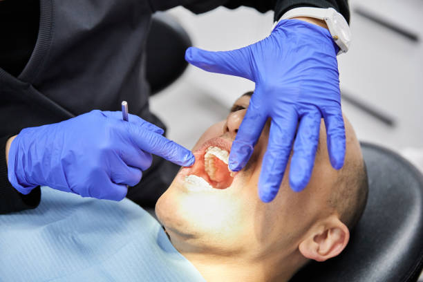 Best Emergency Wisdom Tooth Extraction in Brookville, NY